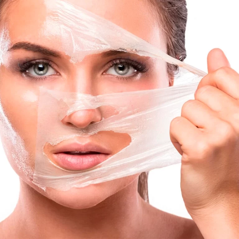 Peeling-2
